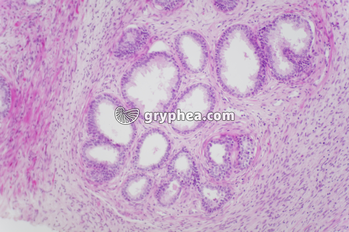 Prostate x40 - gryphea.com